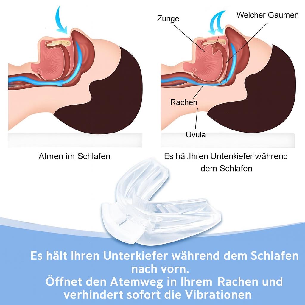 Schnarchstopper und Zahnschiene gegen Bruxismus