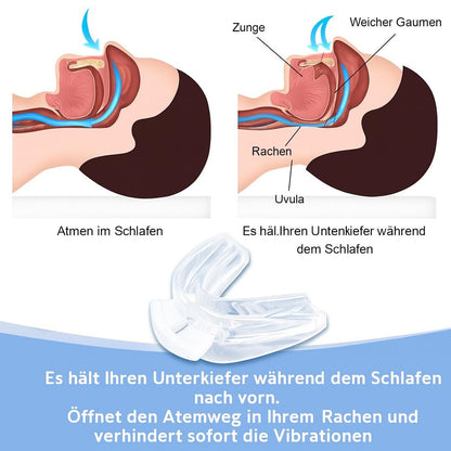 Schnarchstopper und Zahnschiene gegen Bruxismus